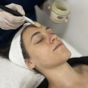 Limpieza facial