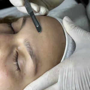 Dermaplaning