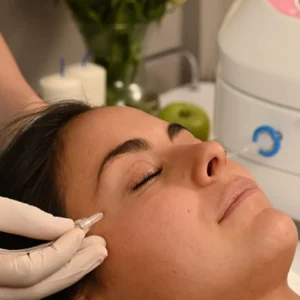 Carboxiterapia facial