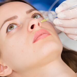 Carboxiterapia facial